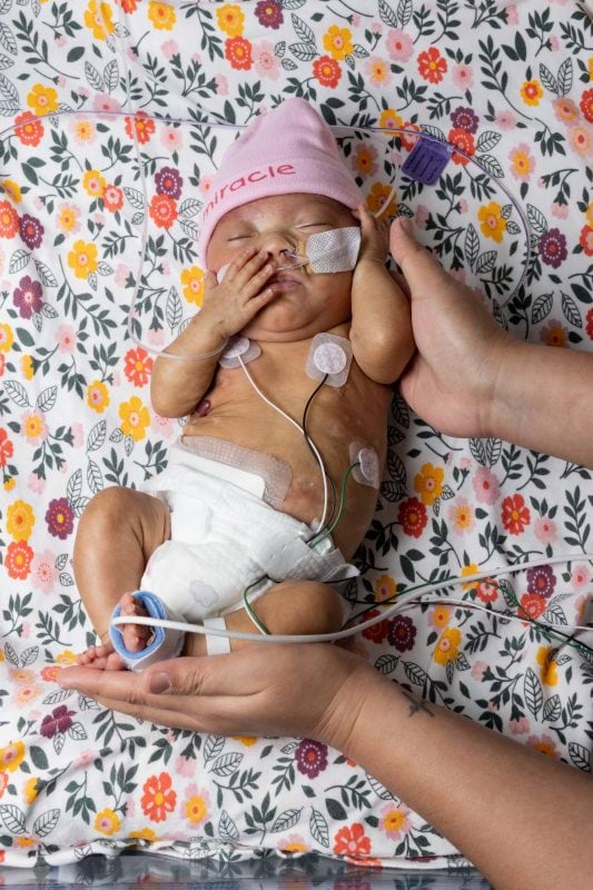 Shiloh as a premature baby lies on a floral-patterned blanket, wearing a pink beanie with the word