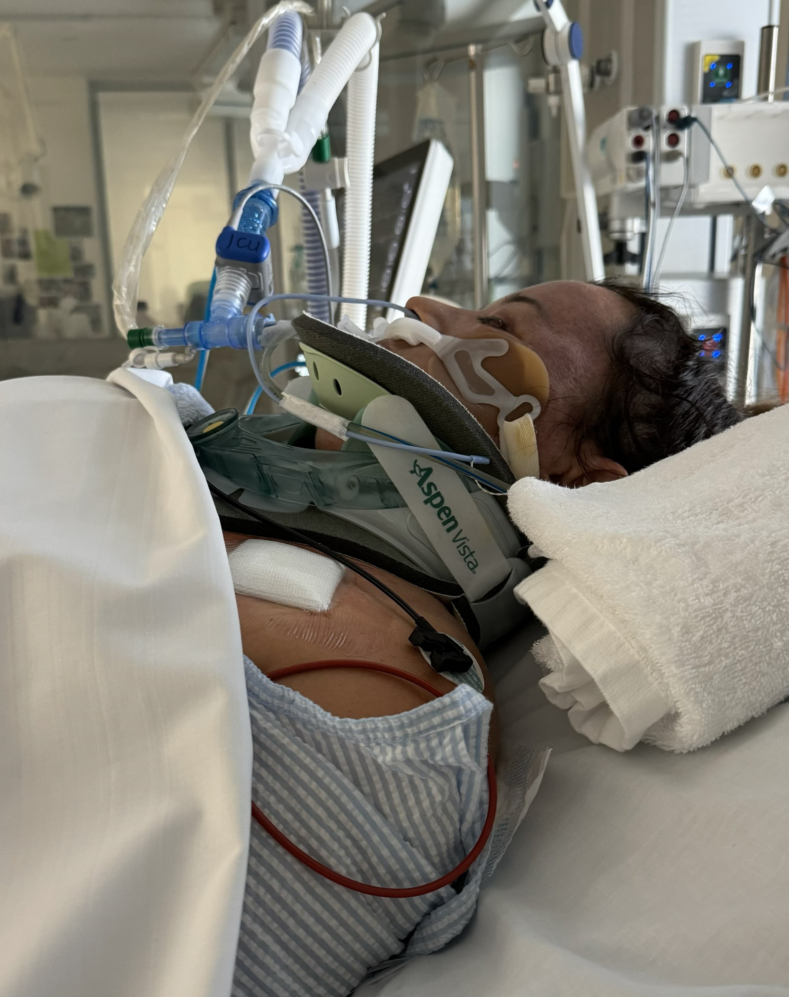 A woman in a neck brace laying in a hospital bed.