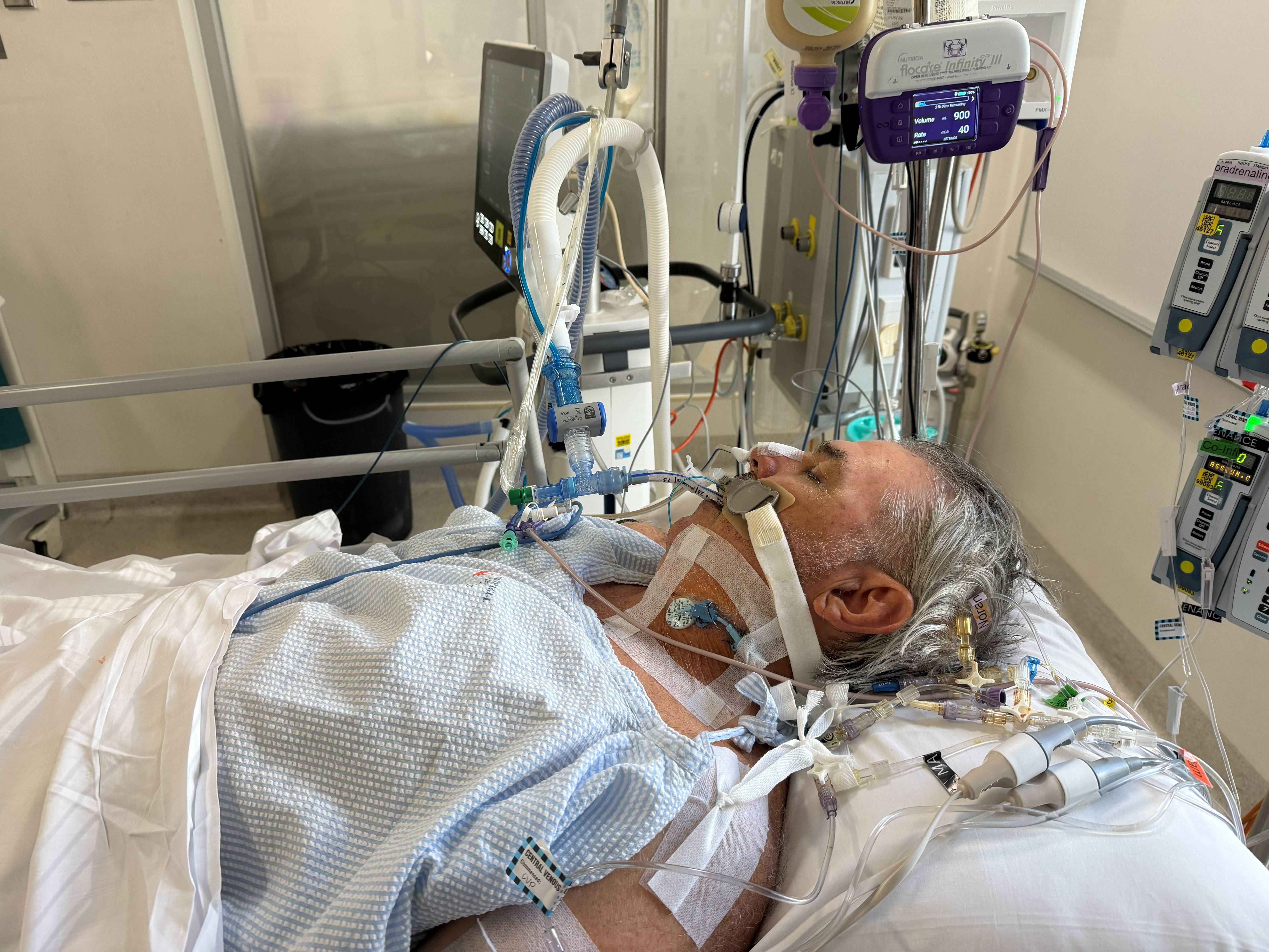 A man in a hospital bed with lots of tubes attached.